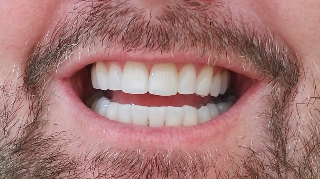 Customer using Provadent for fresher breath and healthy gums