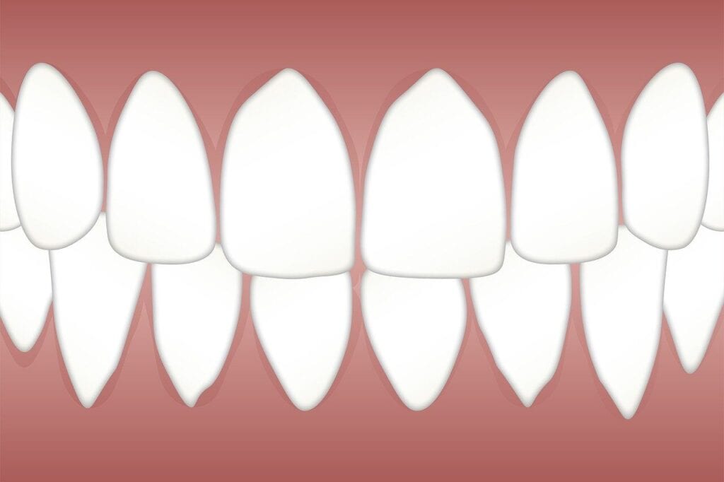 Is Periodontal Disease Curable or Permanent? Real Answers Backed by Science