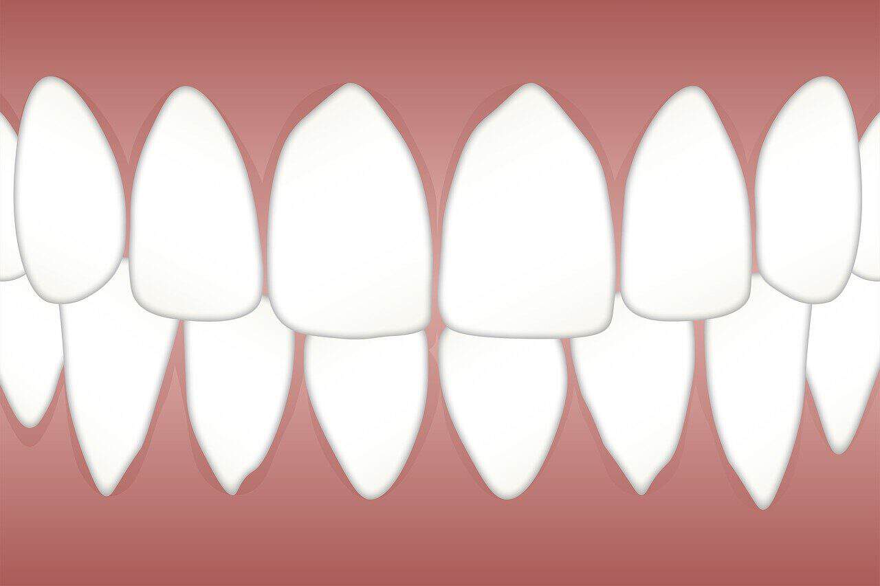 dental, periodontal, disease, white, spot, tongue, patches, dentist, hygiene, teeth, dentistry, tooth, mouth, care, oral, healthcare, clinic, cleanliness, medicine, clean, health, dental, periodontal, periodontal, dentist, teeth, teeth, teeth, tooth, tooth, tooth, tooth, tooth