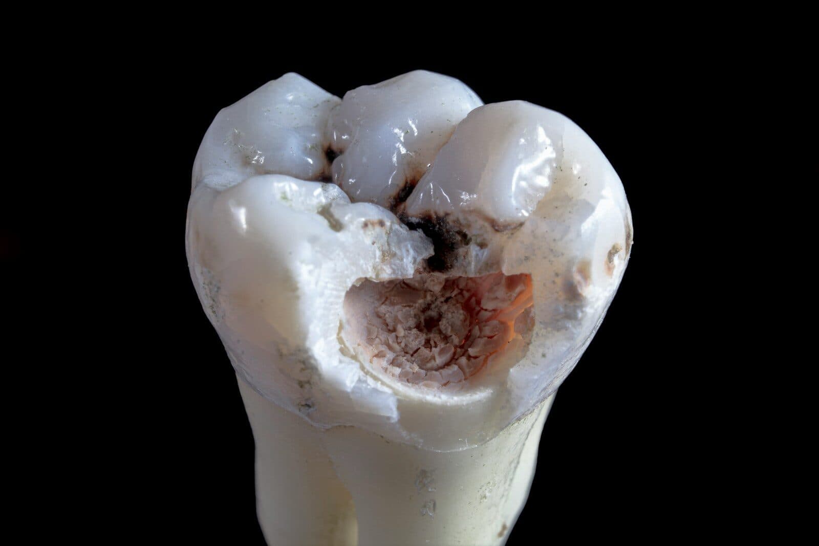 Can Gum Disease Kill You